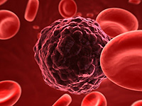 Blut mit Tumorzelle | Im Blut wird das als Dampf aufgenommene Quecksilber in den Erythrozyten und den Leberzellen durch Katalase zu ionisiertem Quecksilber Hg2+ oxidiert. Blut mit Tumorzelle